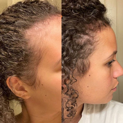 Pumpkin Seed Oil Capsules — 180 Softgels