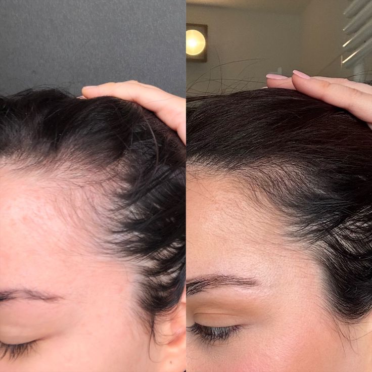 Pumpkin Seed Oil Capsules — 180 Softgels